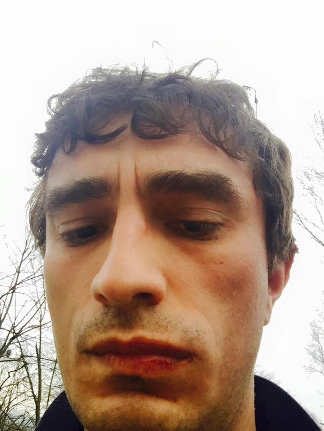 Galeazzo Bignami pugno